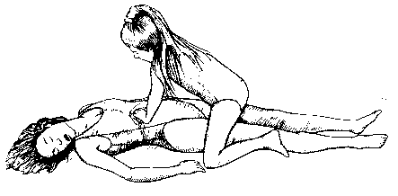Heimlich maneuver being performed on supine victim.