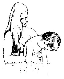 Heimlich maneuver being performed on a
standing victim.