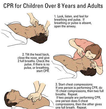 hydrogen Balehval kvarter CPR For Children Over 8 Years and Adults